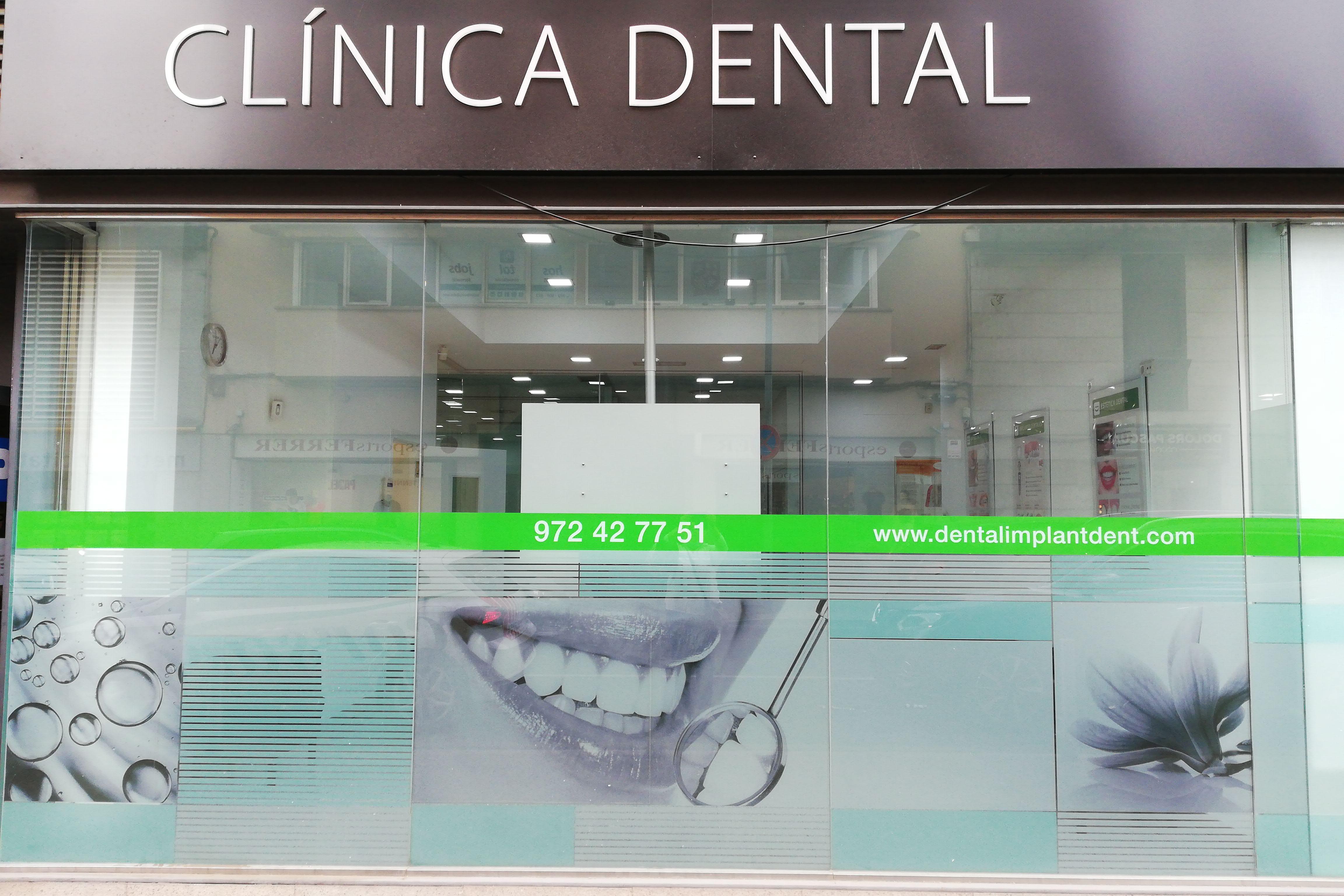 CLINICA DENTAL IMPLANTDENT